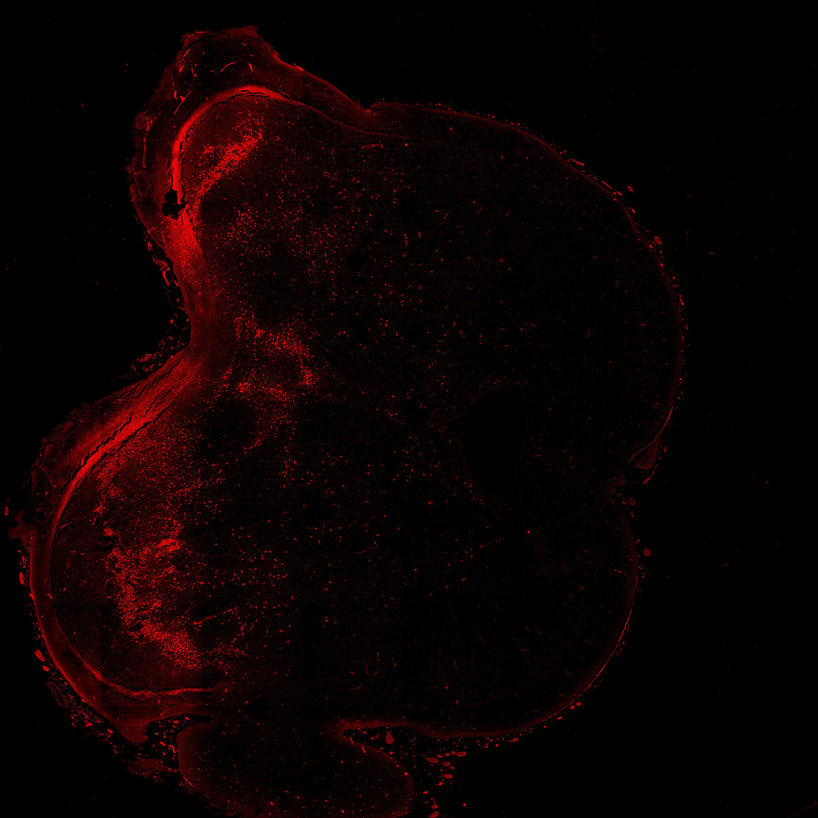 Human foetal midbrain